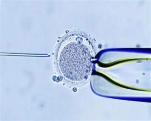 济南第三代试管助孕生男孩费用揭秘：15万预算是否可行？