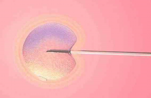 东莞试管婴儿费用、供卵与三代技术：医院选择与助孕攻略