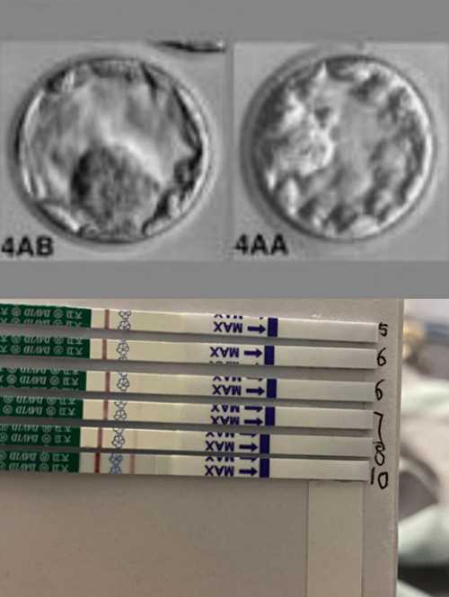 (a)试管代孕公司,香港供卵试管婴儿费用（香港做第三代试管婴儿多少钱）