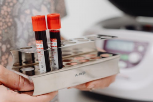 (a)代孕产子公司在哪里,包头能做试管婴儿吗？包头做的试管婴儿如何？