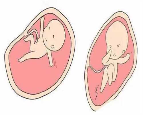 银川血友病三代试管：费用、成功率与医院指南
