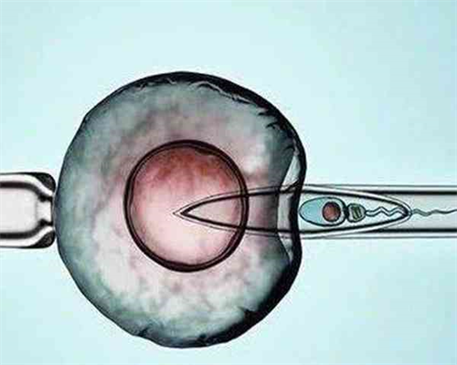高龄试管助孕攻略：提升成功率的关键策略与注意事项