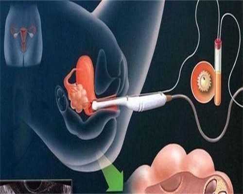 2026年四川省妇幼保健院供卵试管费用：详细明细与助孕指南