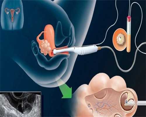 山东辅助生殖：2026年供卵试管生男孩费用指南及推荐医院