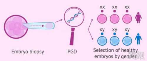 2026佛山供卵试管婴儿费用解析：单周期明细与总览