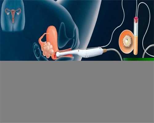 广州供卵试管与辅助生殖指南：费用、流程及权威医院选择