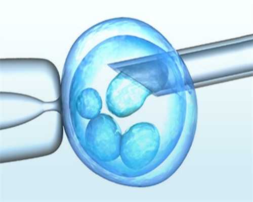 助孕服务~严重少弱精试管成功率