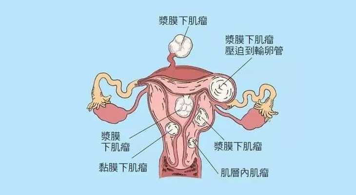 潢川县51岁借卵做试管婴儿成功率_45岁做试管婴儿成功率有多高？