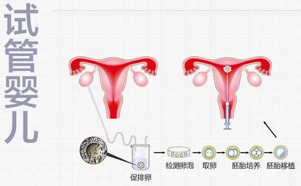 海丰县代妈服务好坤和助孕_泰国试管婴儿促排前一定要打降调针吗？