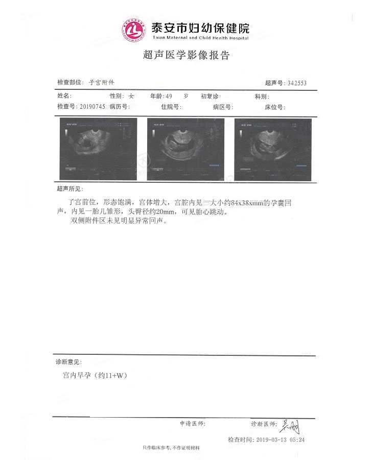武冈市38岁试管婴儿生儿子的机率_49岁试管成功产下双胞胎的好孕经验