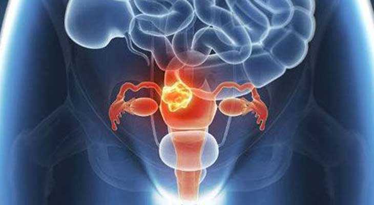 盘锦左侧卵巢性包块_从检查到验孕，泰国试管婴儿具体流程有这8个