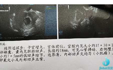 汶川县找个代妈多少钱_泰国杰特宁医院试管婴儿成功率高达90%是真的吗？