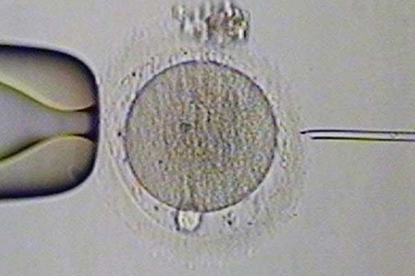 助孕花多少钱_助孕包男孩_俄罗斯试管婴儿基因检测对囊胚会有伤害吗？
