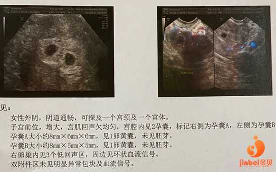 武汉金宝宝助孕公司_好孕好妈官网_泰国试管婴儿如何生双胎？几点建议告诉你